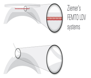 Femto-LDV-System